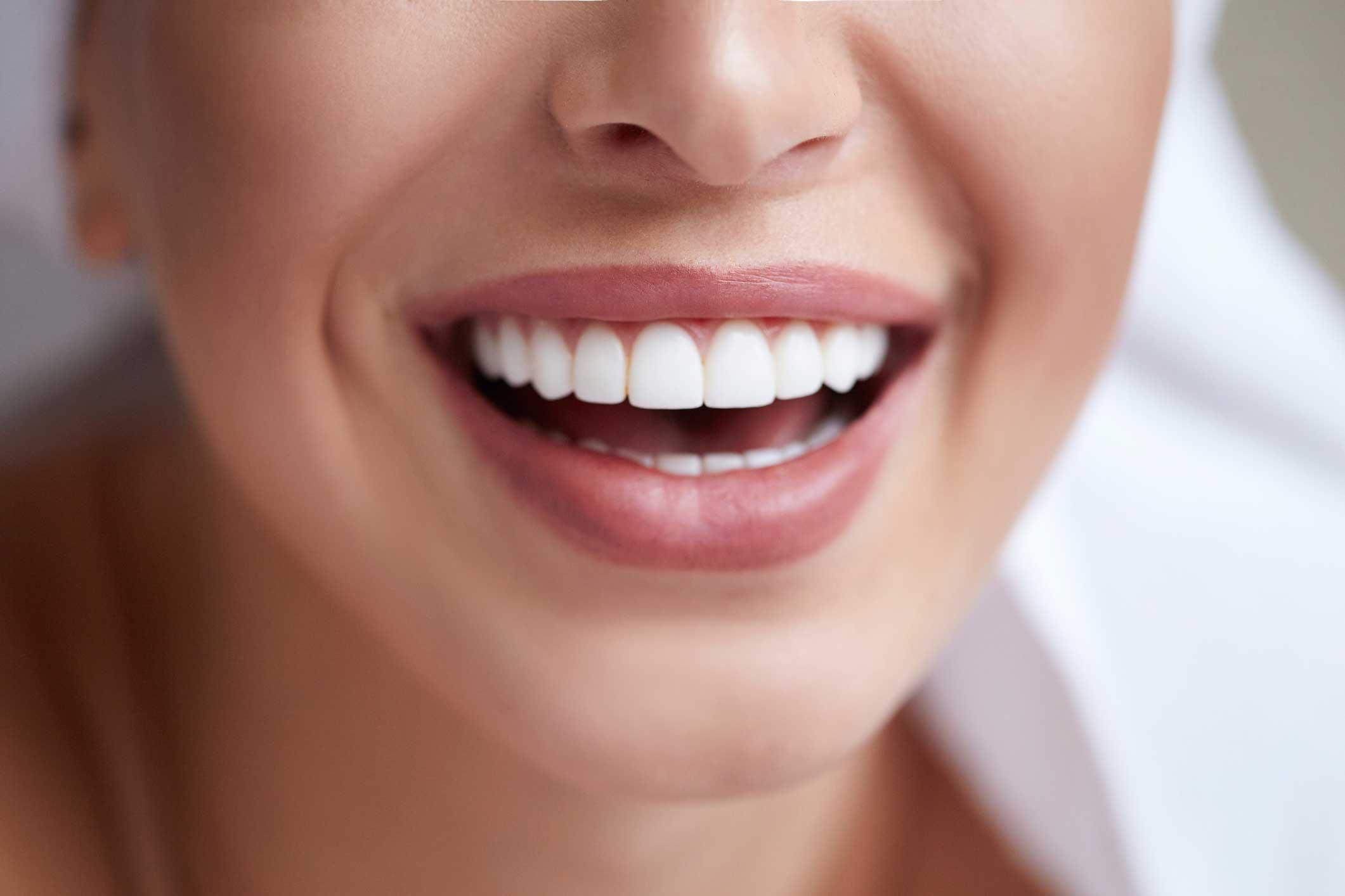 diseno-sonrisa blanqueamiento dental