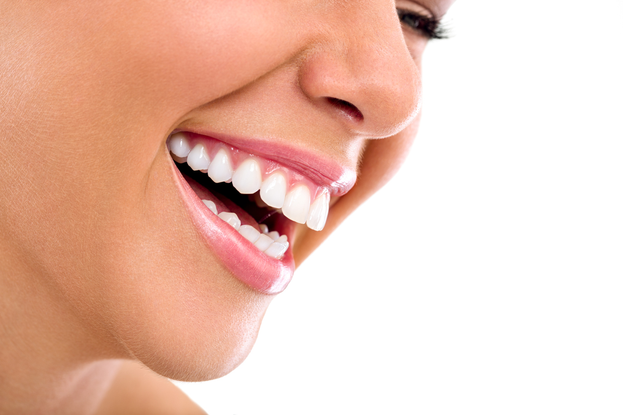 blanqueamiento dental en Santander